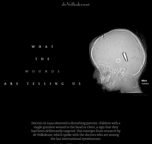 deVolksrant
What
the
wounds
are telling us

X-ray image of small head showing large bullet - Mira 4 years
Beeld: Mimi Syed
Doctors in Gaza observed a disturbing pattern: children with a single gunshot wound to the head or chest, a sign that they had been deliberately targeted. This emerges from research by de Volkskrant, which spoke with the doctors who are among the last international eyewitnesses.